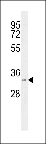 HSD17B11 Antibody