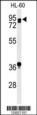 PATL1 Antibody