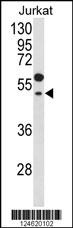 GNAT1 Antibody