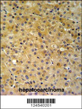 NDUFA10 Antibody