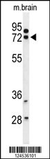 HSPA12A Antibody