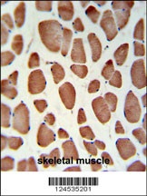 HSD11B2 Antibody