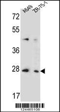 TM4SF4 Antibody