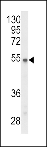 P2R3C Antibody