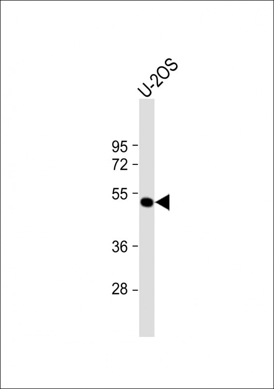 ANKH Antibody