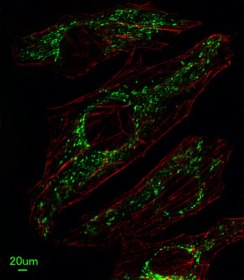 SLC25A37 Antibody