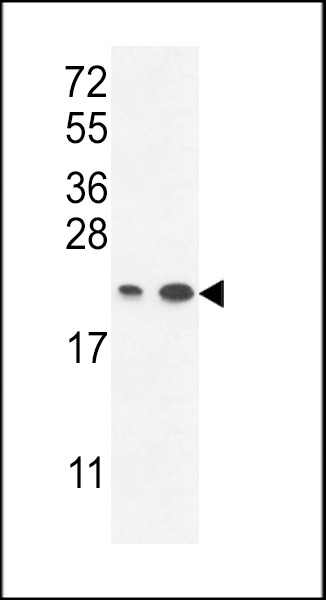 ABHD14B Antibody