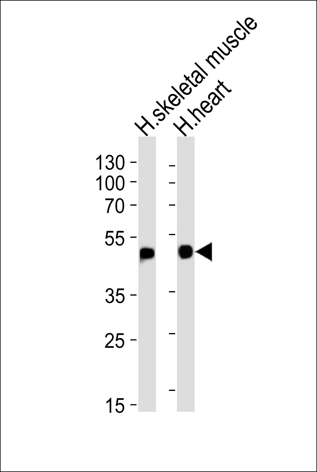 HFE2 Antibody