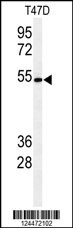 POGLUT1 Antibody
