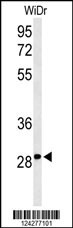 NMRK1 Antibody