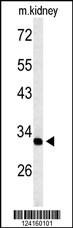 TMUB2 Antibody