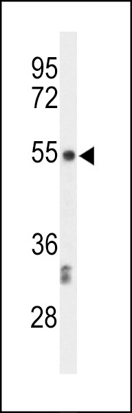 CENPI Antibody