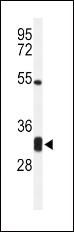 CPSF4 Antibody