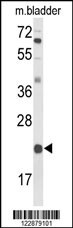 DGCR6 Antibody