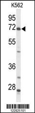 ACSS2 Antibody