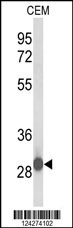 KATNBL1 Antibody