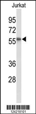 SACM1L Antibody