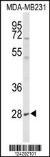 YIPF5 Antibody