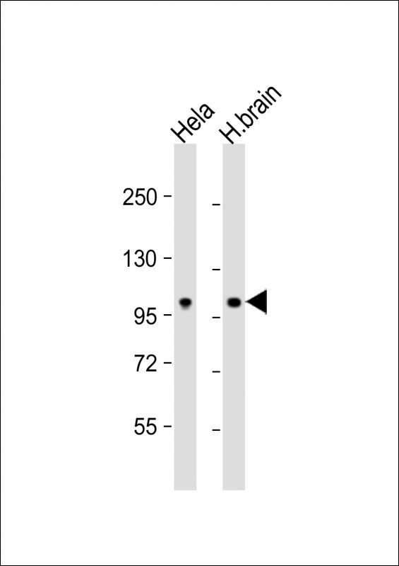 NCOA7 Antibody