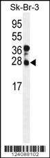 CHMP4B Antibody