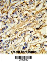 CHMP4B Antibody