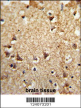 EIF2A Antibody