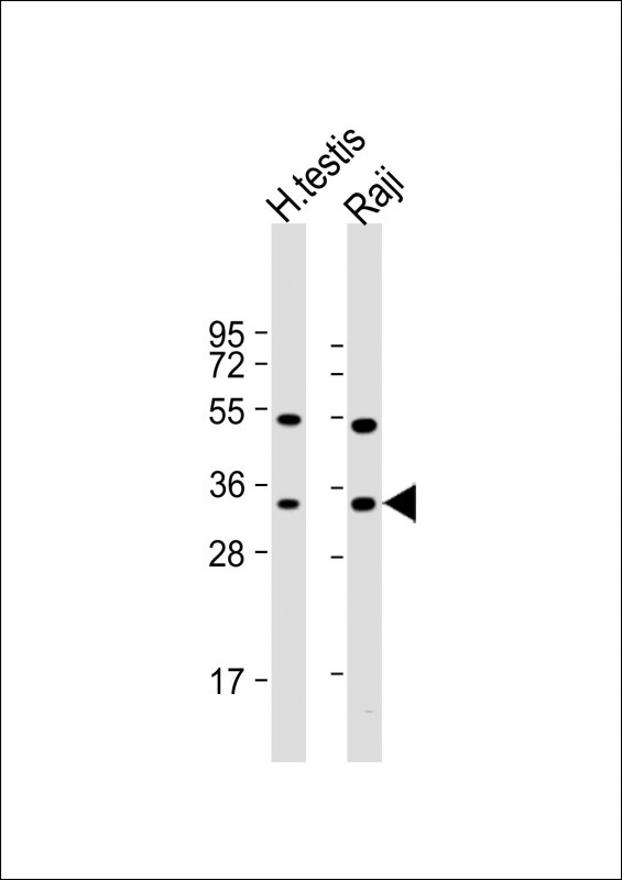 HSD17B3 Antibody