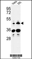 HS3ST2 Antibody