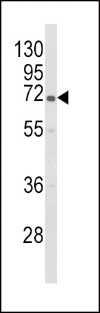 GBE1 Antibody