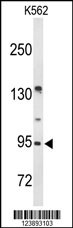 BRINP3 Antibody