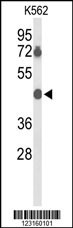 BTBD10 Antibody