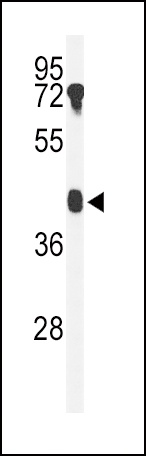 B4GALT2 Antibody
