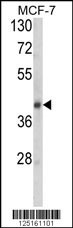 SERPINA9 Antibody