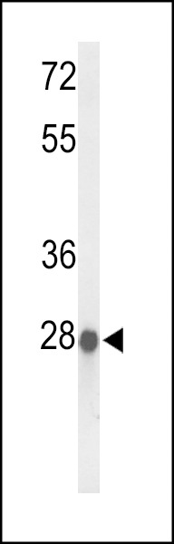 ABHD11 Antibody