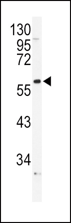 ADRA1B Antibody