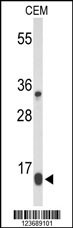 DIRAS1 Antibody