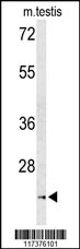 UNC119 Antibody