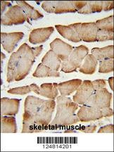 TMEM150A Antibody