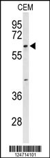 TCHP Antibody