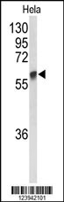 GALNT2 Antibody