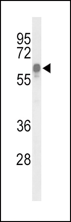 ITPKC Antibody