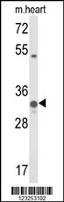 COQ5 Antibody