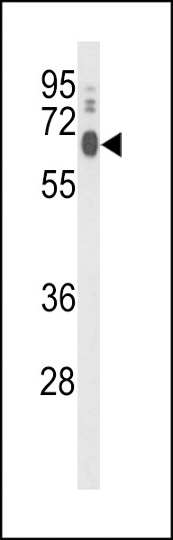 LPCAT1 Antibody