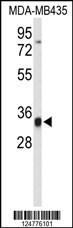 TFPT Antibody