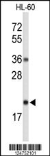 RNASEH2C Antibody