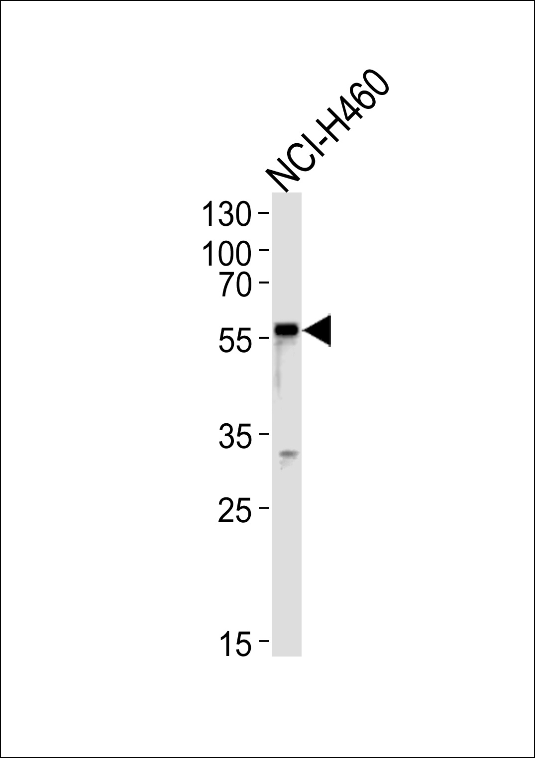 GABRA2 Antibody