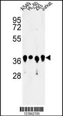ARGLU1 Antibody