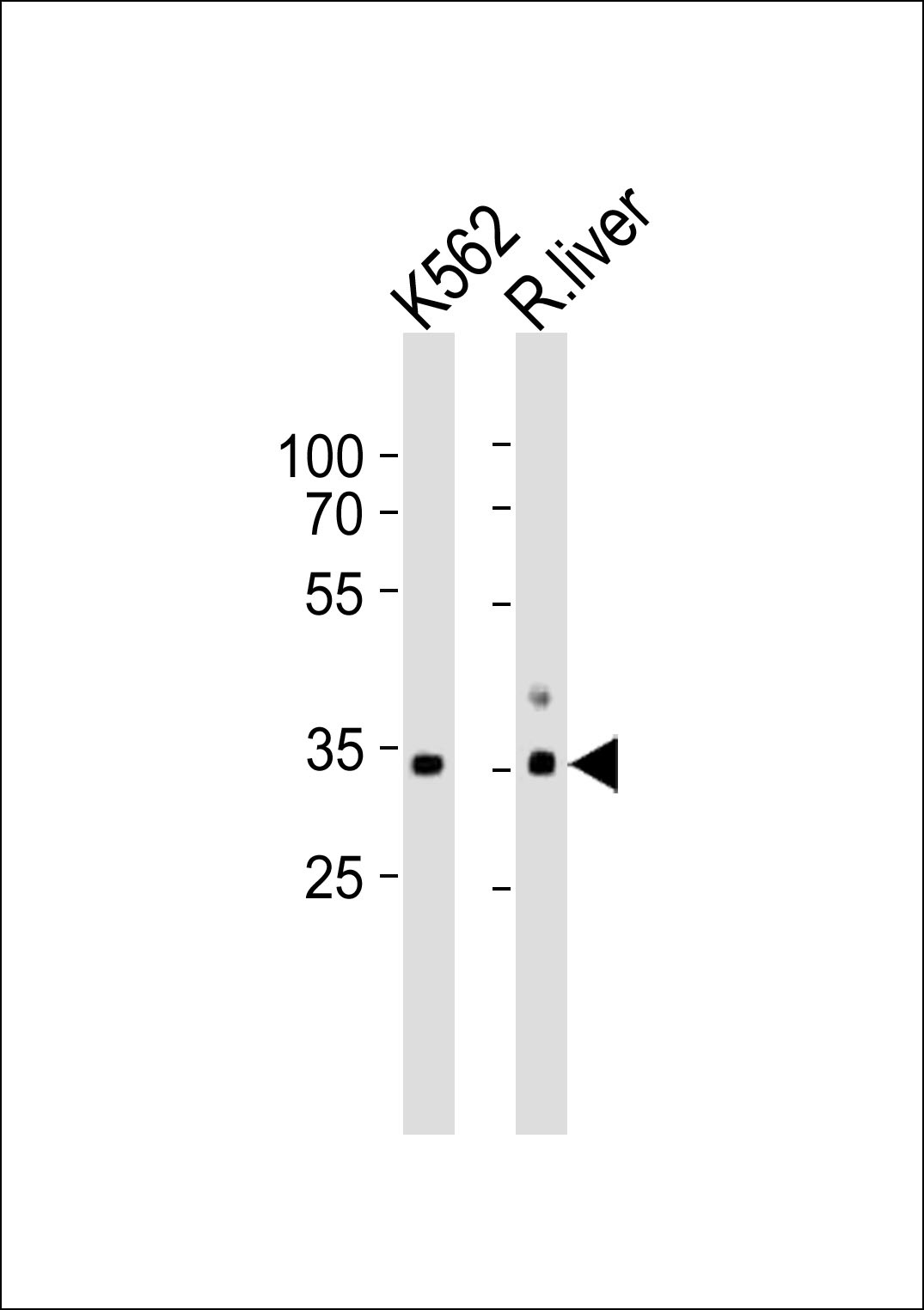 ATP1B2 Antibody