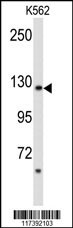 PLCB2 Antibody