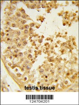 WDR37 Antibody